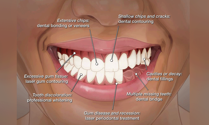 ഇനി ചിരിക്കാം ആത്മവിശ്വാസത്തോടെ