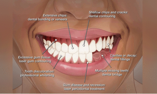 ഇനി ചിരിക്കാം ആത്മവിശ്വാസത്തോടെ