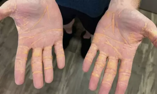 പ്രോട്ടീൻ മാത്രം കഴിച്ചാലെന്താകും?