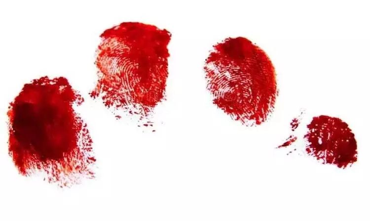 ഇൻക്വസ്റ്റ്