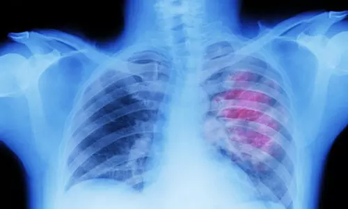 പുകവലിക്കാത്തവരിലും ശ്വാസകോശ കാൻസർ വർധിക്കുന്നു