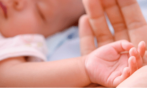 representationl image