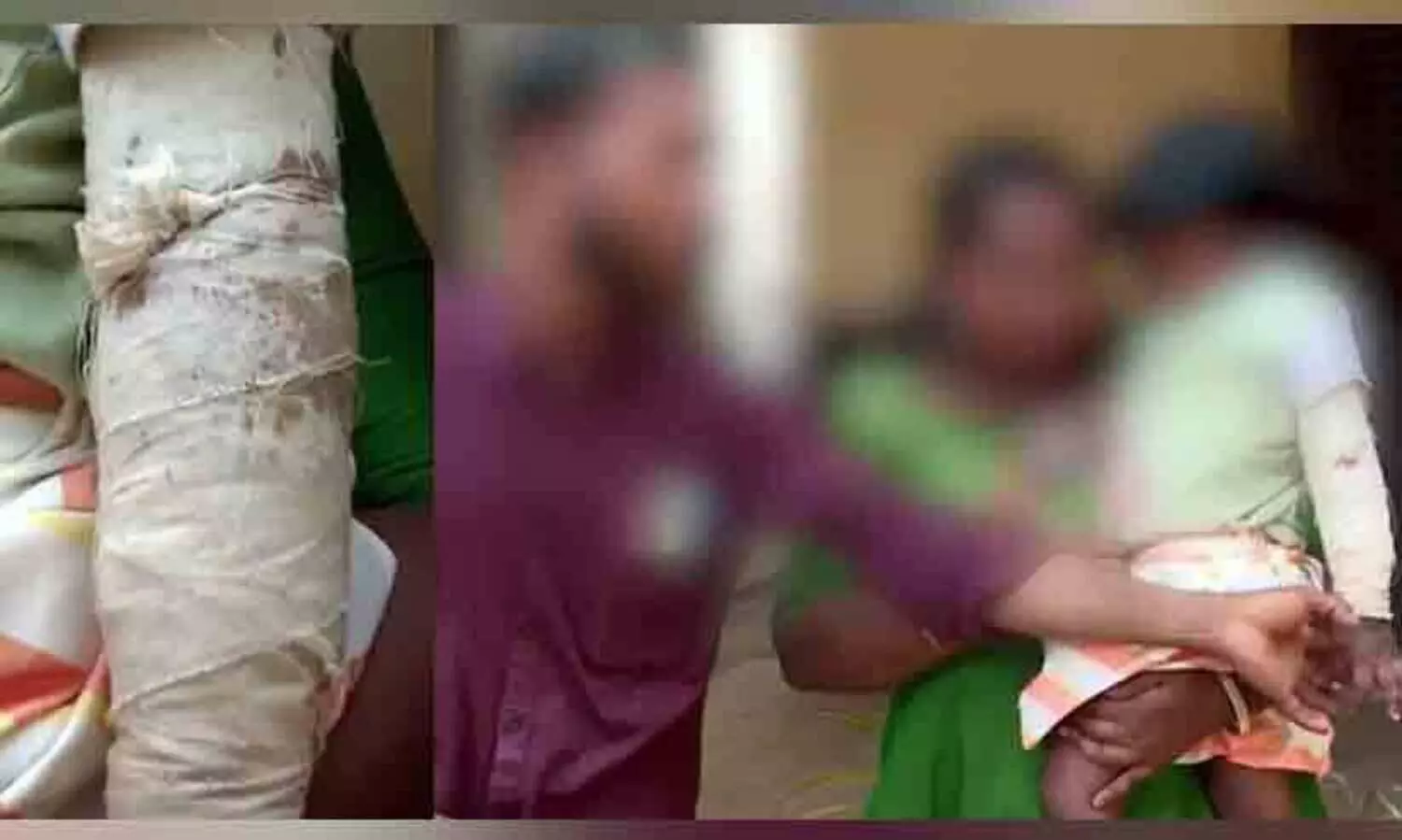 മൂന്ന് വയസുകാരിയുടെ കൈ പിടിച്ച് തിരിച്ചു; അംഗനവാടി അധ്യാപികക്കെതിരെ പരാതിയുമായി കുടുംബം