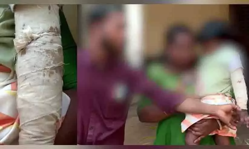 മൂന്ന് വയസുകാരിയുടെ കൈ പിടിച്ച് തിരിച്ചു; അംഗനവാടി അധ്യാപികക്കെതിരെ പരാതിയുമായി കുടുംബം മൂന്ന് വയസുകാരിയുടെ കൈ പിടിച്ച് തിരിച്ചു; അംഗനവാടി അധ്യാപികക്കെതിരെ പരാതിയുമായി കുടുംബം