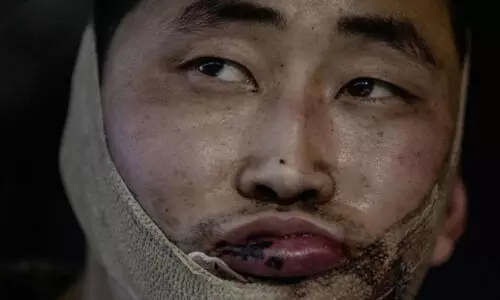 യുക്രെയ്ൻ യുദ്ധത്തിൽ ‘അപ്രത്യക്ഷരായി’ ഉത്തരകൊറിയൻ സൈനികർ; കണക്കെടുത്ത് ദക്ഷിണ ​​കൊറിയ