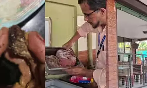 അൽഫാമിൽ പുഴു; കോഴിക്കോട് കാറ്ററിങ് യൂണിറ്റ് അടച്ചുപൂട്ടി