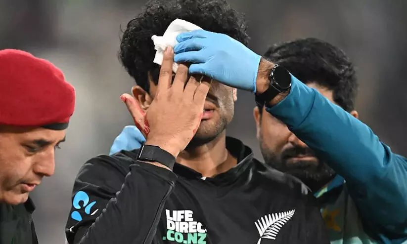 വില്ലനായി പാക് സ്റ്റേഡിയത്തിലെ വെളിച്ചം; പന്ത് നെറ്റിയിലിടിച്ച് ചോരവന്നതോടെ കളംവിട്ട് രചിൻ രവീന്ദ്ര വില്ലനായി പാക് സ്റ്റേഡിയത്തിലെ വെളിച്ചം; പന്ത് നെറ്റിയിലിടിച്ച് ചോരവന്നതോടെ കളംവിട്ട് രചിൻ രവീന്ദ്ര