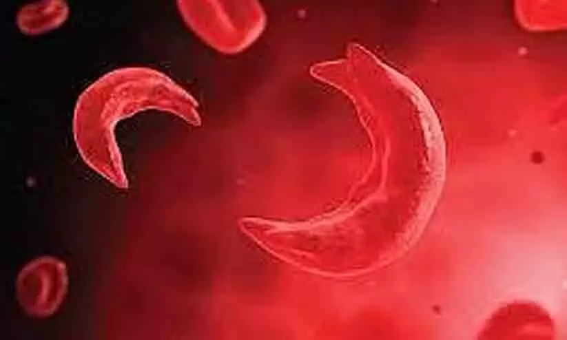 Representative Photo Representative Photo