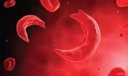 Representative Photo