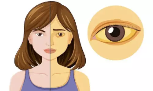 മഞ്ഞപ്പിത്തത്തിനെതിരെ ജാഗ്രത പുലർത്തണം -ഡി.എം.ഒ