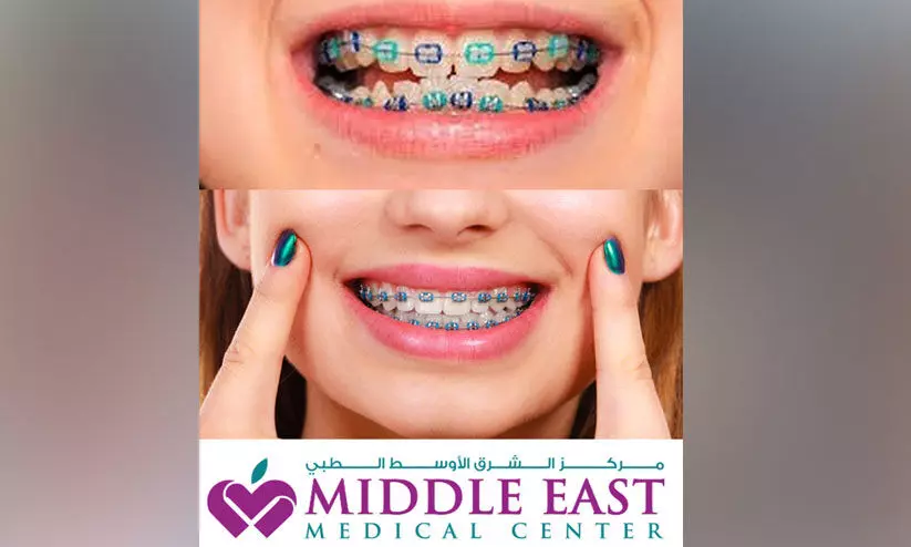 ഒർത്തോഡോണ്ടിക്സ്: മനോഹരമായ പുഞ്ചിരിയും ആരോഗ്യകരമായ ഭാവിയും