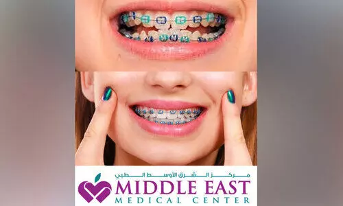 ഒർത്തോഡോണ്ടിക്സ്: മനോഹരമായ പുഞ്ചിരിയും ആരോഗ്യകരമായ ഭാവിയും