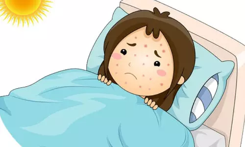 വൈ​റ​ൽ​പ​നി​യും പ​ട​രു​ന്നു; ചൂടും ഒപ്പം ചിക്കന്‍പോക്‌സും