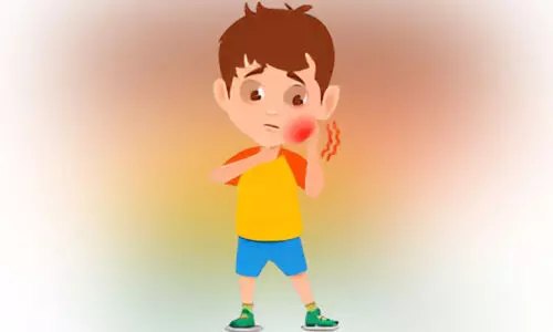 വിദ്യാർഥികളിൽ മുണ്ടിനീര്​; രക്ഷിതാക്കൾ ആശങ്കയിൽ