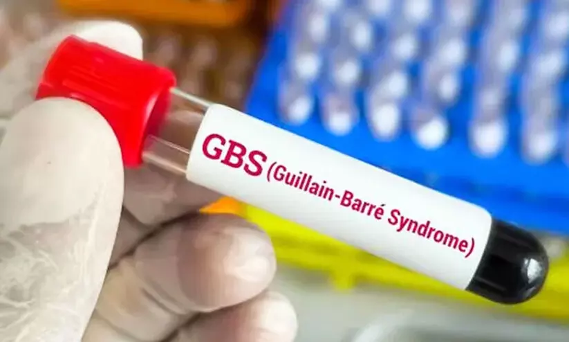 Guillain Barre Syndrome Guillain Barre Syndrome