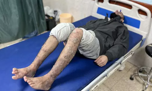 അടുത്തഘട്ട വെടിനിർത്തൽ ചർച്ചക്ക് തയാറെന്ന് ഹമാസ്; മധ്യസ്ഥരെ കൈറോയിലേക്ക് അയക്കുമെന്ന് നെതന്യാഹു അടുത്തഘട്ട വെടിനിർത്തൽ ചർച്ചക്ക് തയാറെന്ന് ഹമാസ്; മധ്യസ്ഥരെ കൈറോയിലേക്ക് അയക്കുമെന്ന് നെതന്യാഹു