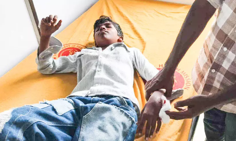 കായംകുളത്ത് മൂന്നുപേർക്ക് തെരുവുനായുടെ കടിയേറ്റു