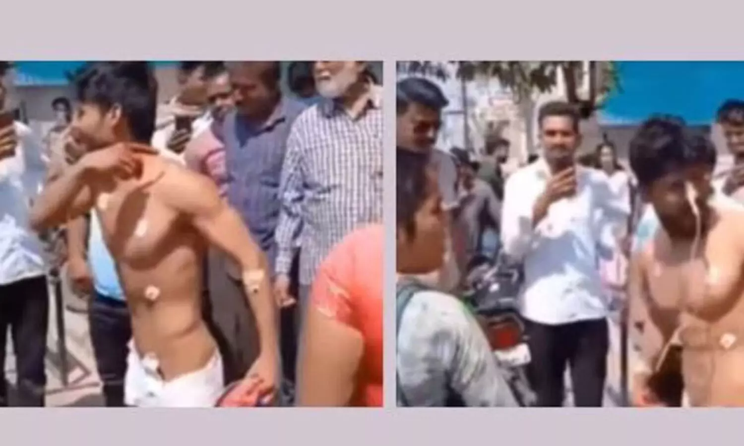 ഡോക്ടർമാർ ‘കോമ’യിലാണെന്ന്’ പറഞ്ഞ രോഗി ഐ.സി.യുവിൽ നിന്ന് പുറത്തുചാടി -വിഡിയോ