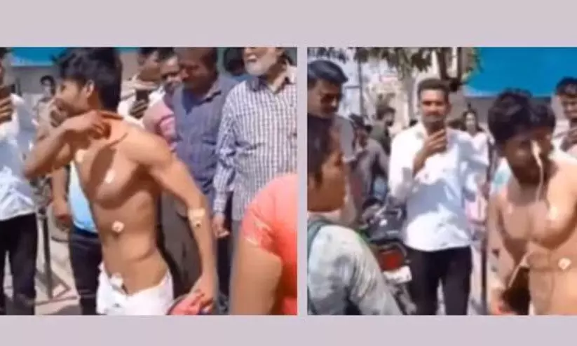 ഡോക്ടർമാർ ‘കോമ’യിലാണെന്ന്’ പറഞ്ഞ രോഗി ഐ.സി.യുവിൽ നിന്ന് പുറത്തുചാടി -വിഡിയോ