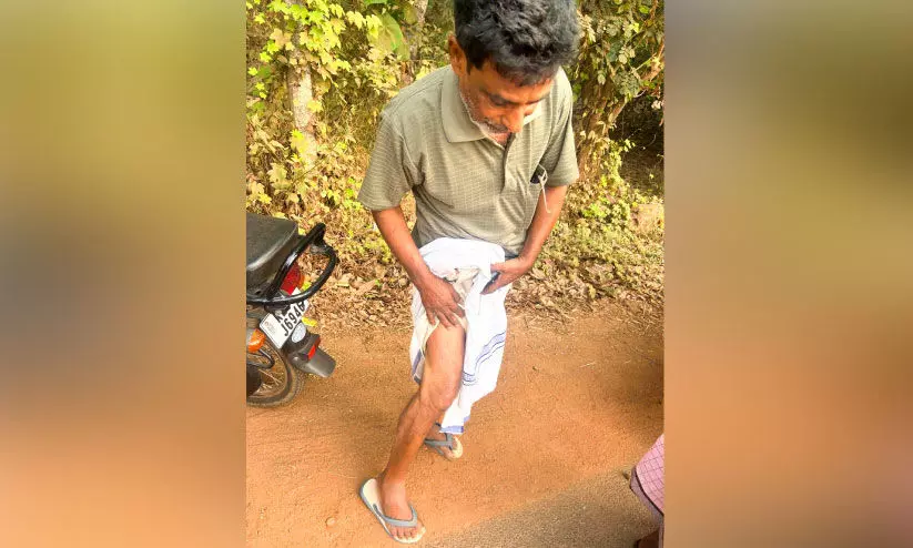 മമ്പാട്ട് പുലിയുടെ ആക്രമണത്തിൽ ബൈക്ക് യാത്രികന് പരിക്ക്