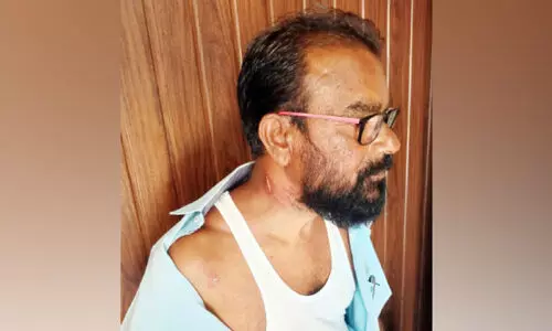 ചൂട് കൂടുന്നു; വേണം അതീവ ജാഗ്രത