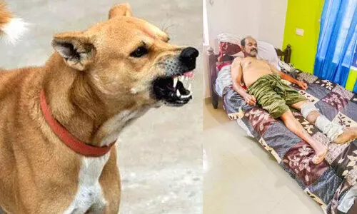 കലിയടങ്ങാതെ തെരുവുനായ്ക്കൾ; മുൻ പ്രവാസിക്കും അഞ്ചുവയസ്സുകാരനും കടിയേറ്റു