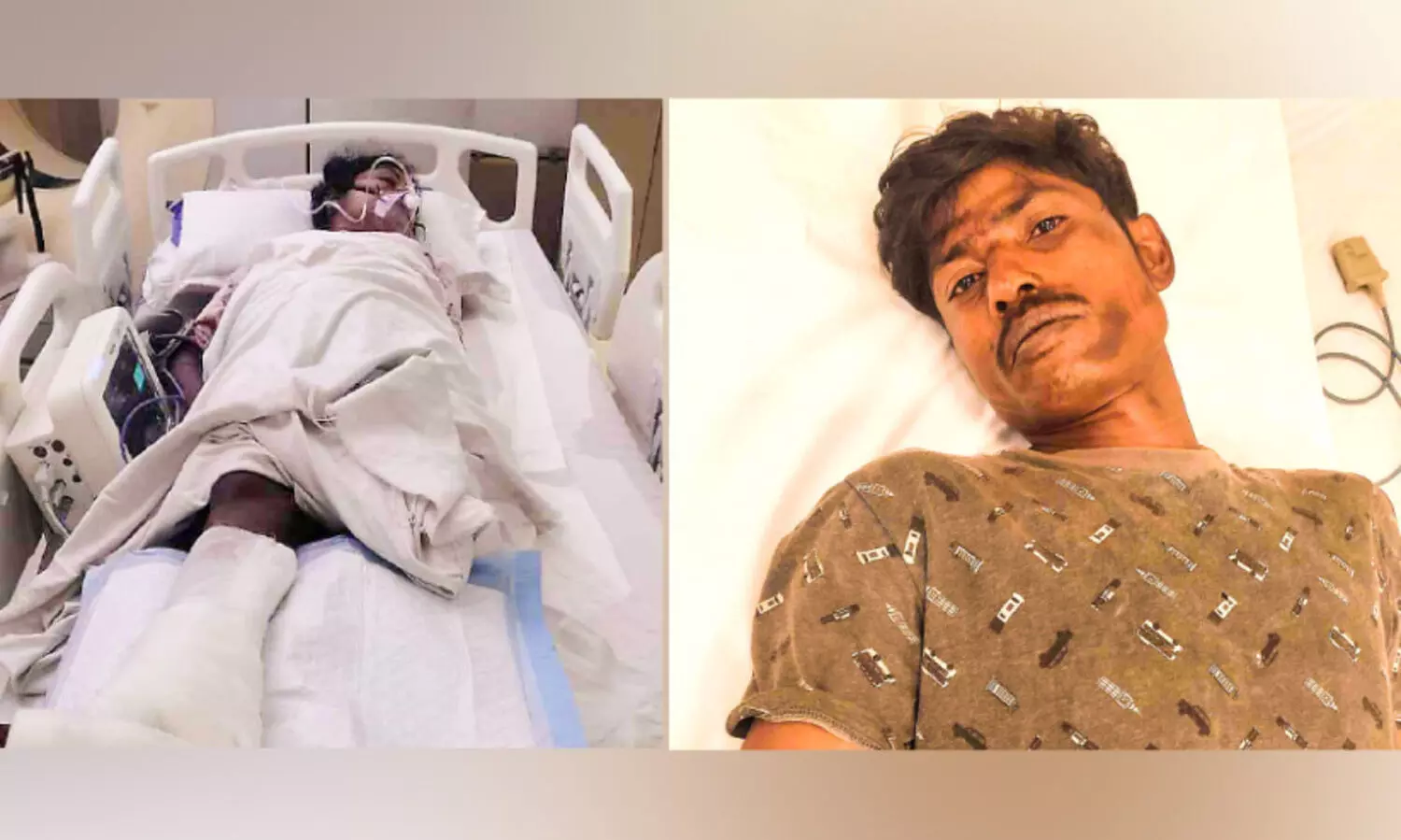 കാട്ടാന ആക്രമണത്തിൽ രണ്ടുപേർക്ക് പരിക്ക്