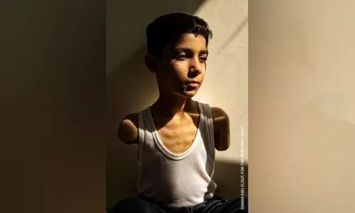 ഇസ്രായേൽ ക്രൂരതയുടെ നേർചിത്രത്തിന് വേൾഡ് പ്രസ് ഫോട്ടോ പുരസ്കാരം