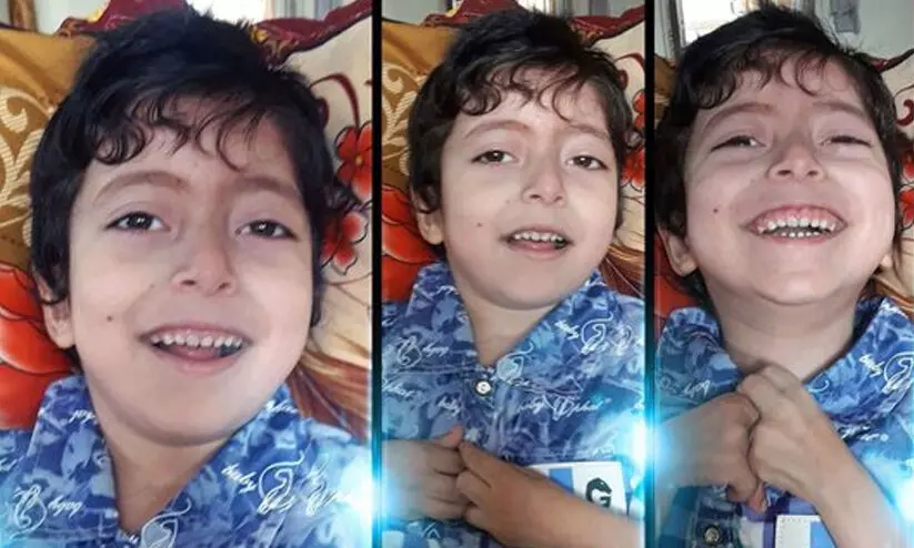 Palestinian child Ahmed Zuhair Abu Al Rous was burned to death in the Israeli bombing Palestinian child Ahmed Zuhair Abu Al Rous was burned to death in the Israeli bombing