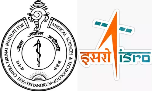 ബഹിരാകാശ വൈദ്യശാസ്ത്ര സഹകരണം; ശ്രീചിത്ര തിരുനാൾ ഇൻസ്റ്റിറ്റ്യൂട്ടും ഐ.എസ്.ആർ.ഒയും ധാരണയിൽ