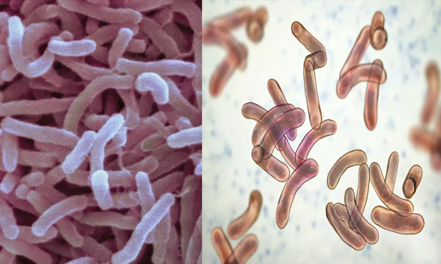 തിരുവനന്തപുരത്ത് കോളറ ബാധിച്ച് ഒരാൾ മരിച്ചു; ജാഗ്രതയിൽ   ആരോഗ്യവിഭാഗം