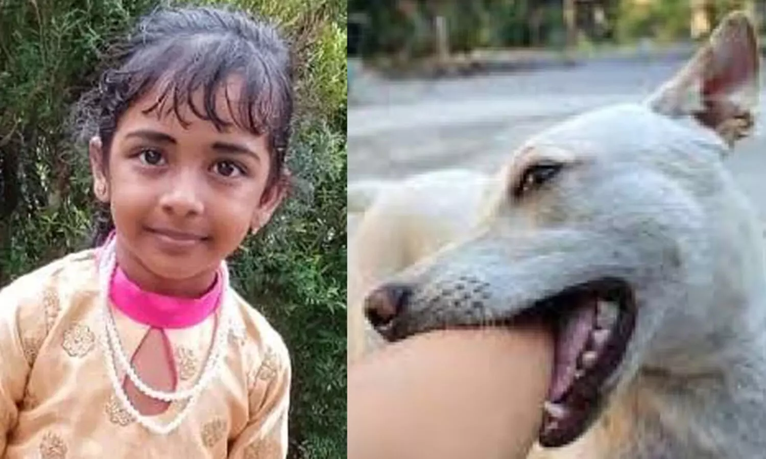 തലയിൽ ആഴത്തിലുള്ള മുറിവുകൾ, സോപ്പിട്ട് കഴുകാൻ വൈകി, വൈറസ് അതിവേഗം തലച്ചോറിലേക്ക് ബാധിച്ചു; പേ വിഷബാധയേറ്റ് അഞ്ചര വയസുകാരി മരിച്ചതിനെ കുറിച്ച് ഡോക്ടർമാർ