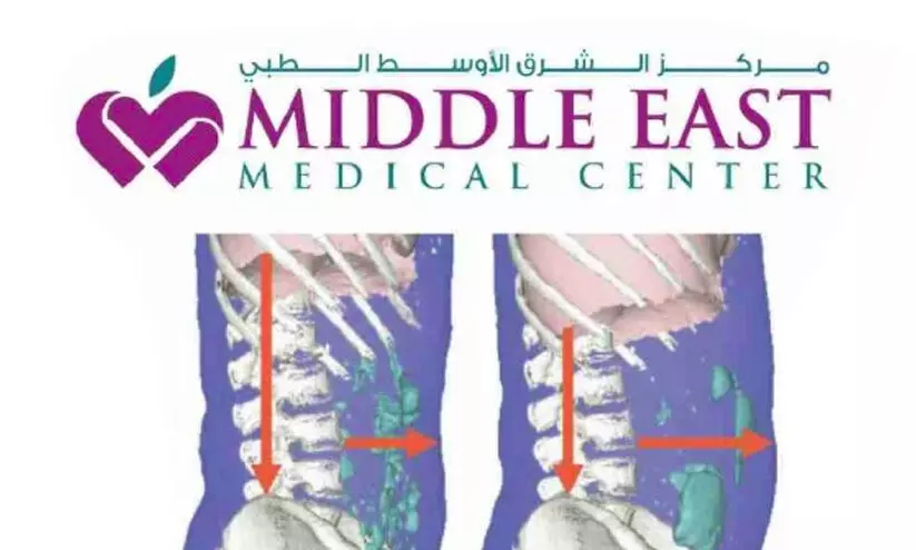ആയുർവേദത്തിലൂടെ ഗ്യാസ്ട്രിക് പ്രശ്നങ്ങൾക്ക് പരിഹാരം