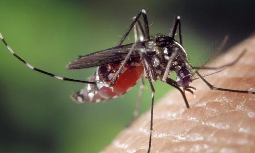 Representative Image