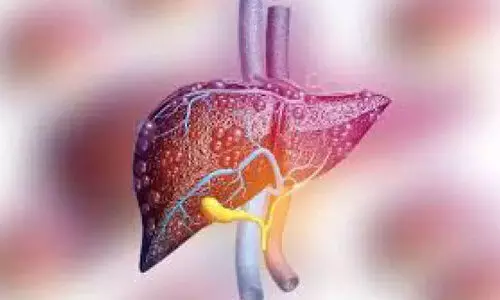 പെരിങ്ങത്തൂർ മേഖലയിൽ മഞ്ഞപ്പിത്തം പടരുന്നു