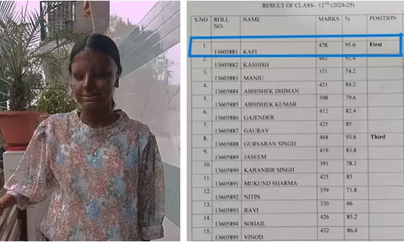 മൂന്നാം വയസിൽ ആസിഡ് ആക്രമണത്തിന് ഇര, പൊള്ളലേറ്റ് കാഴ്ച ശക്തി നഷ്ടപ്പെട്ടു; തളരാതെ പഠിച്ച് കാഫി നേടിയത് 12ാം ക്ലാസിലെ ഒന്നാം സ്ഥാനം