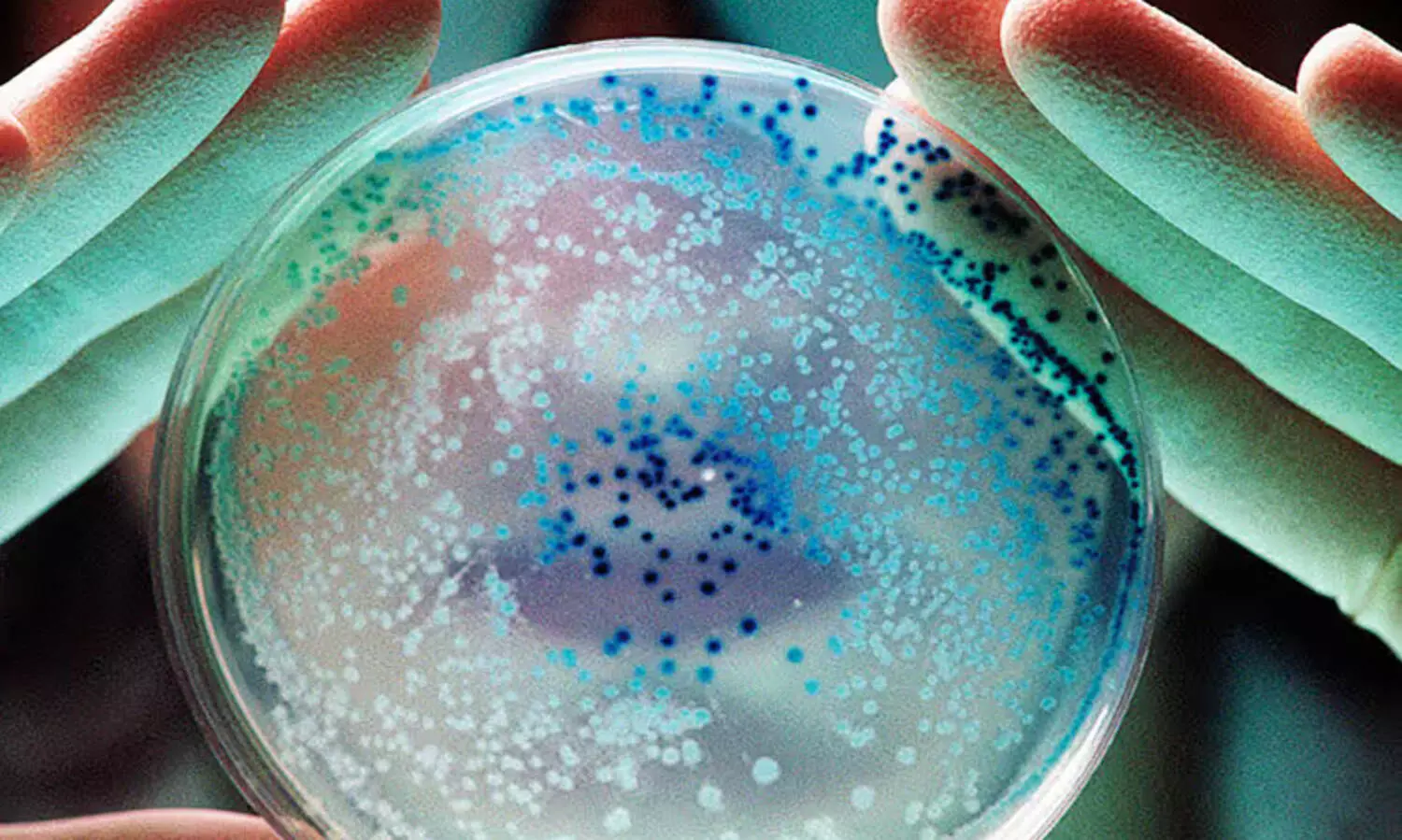 തലവടിയിലെ രഘുവിന്‍റെ മരണം കോളറയല്ല;   കുട്ടനാട്ടിൽ ആരോഗ്യവകുപ്പ്​ ജാഗ്രതനിർദേശം തുടരും