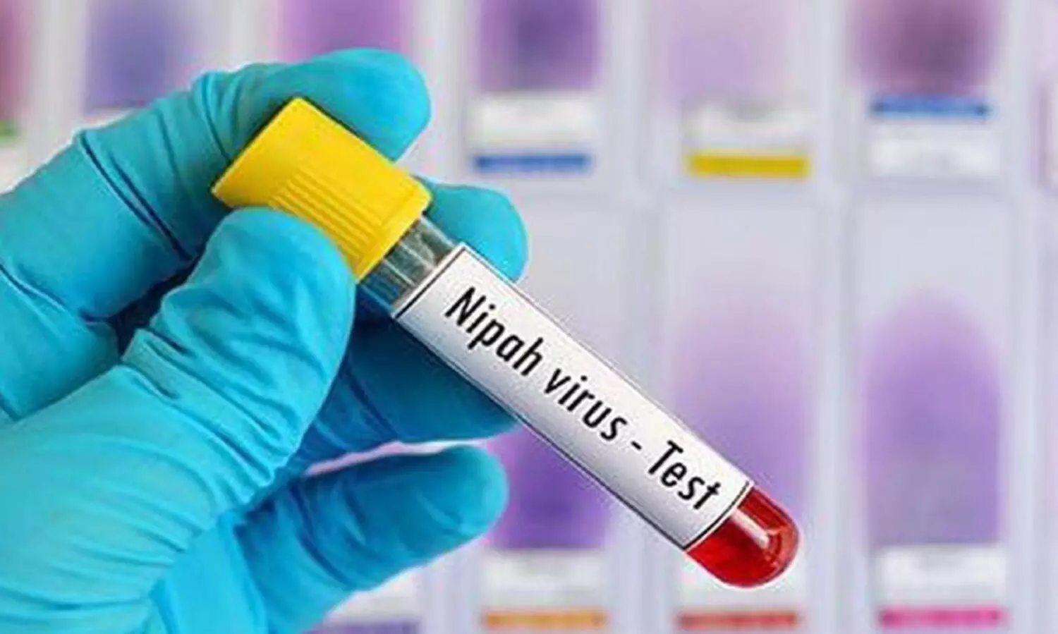 നിപ: മൂന്ന് ജില്ലകളിൽ ജാഗ്രതാനിർദേശം നൽകി ആരോഗ്യവകുപ്പ്