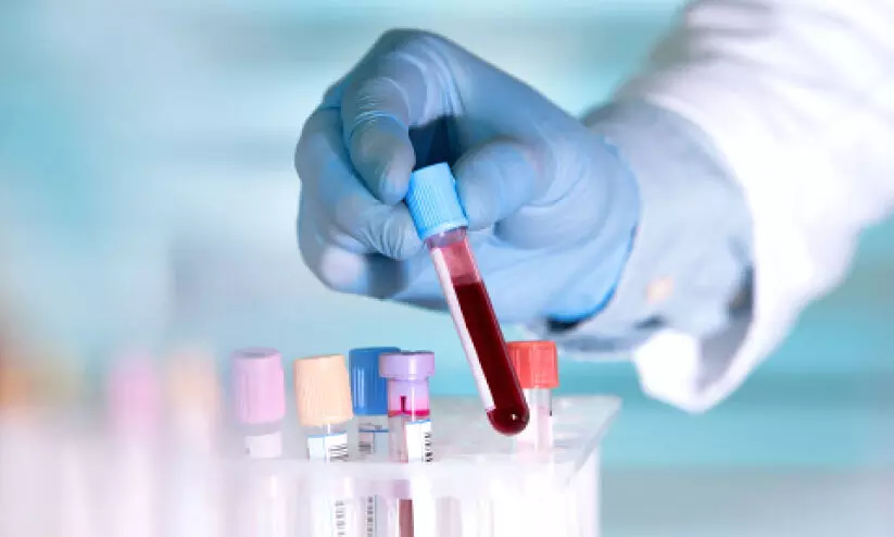 Inconclusive HIV test results could lead to visa denial Inconclusive HIV test results could lead to visa denial