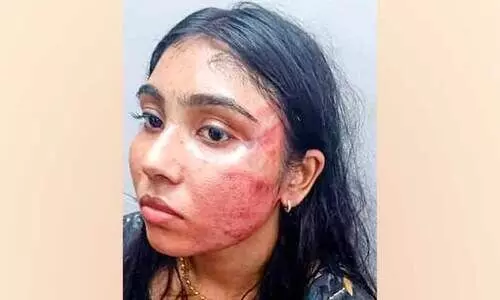 തെളിവ്​ എന്‍റെ മുഖത്തുണ്ട്; അധിക്ഷേപിക്കുന്ന   സഹപ്രവർത്തകരോട്​ ശ്യമിലി