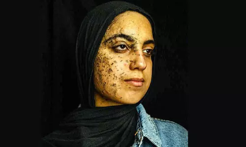 യു​ദ്ധം ബാ​ക്കി​യാ​ക്കു​ന്ന ജീ​വി​തം