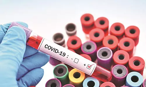 വീണ്ടും കോവിഡ് ആശങ്ക; സംസ്ഥാനത്ത്​ 273 പേർക്ക്​; ജി​ല്ല​ക​ൾ നി​രീ​ക്ഷ​ണം ശ​ക്ത​മാ​ക്കാ​ൻ നി​ർ​ദേ​ശം