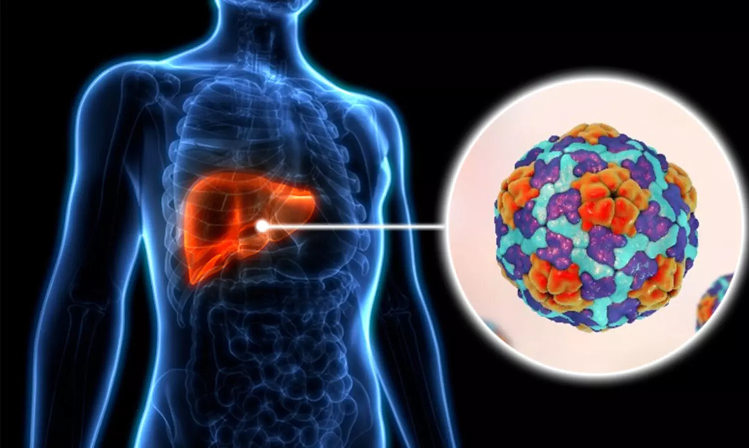 ഹെ​പ്പ​റ്റൈ​റ്റി​സ് എ ​ആ​രം​ഭ​ത്തി​ല്‍  ചി​കി​ത്സി​ക്ക​ണം-​ഡി.​എം.​ഒ