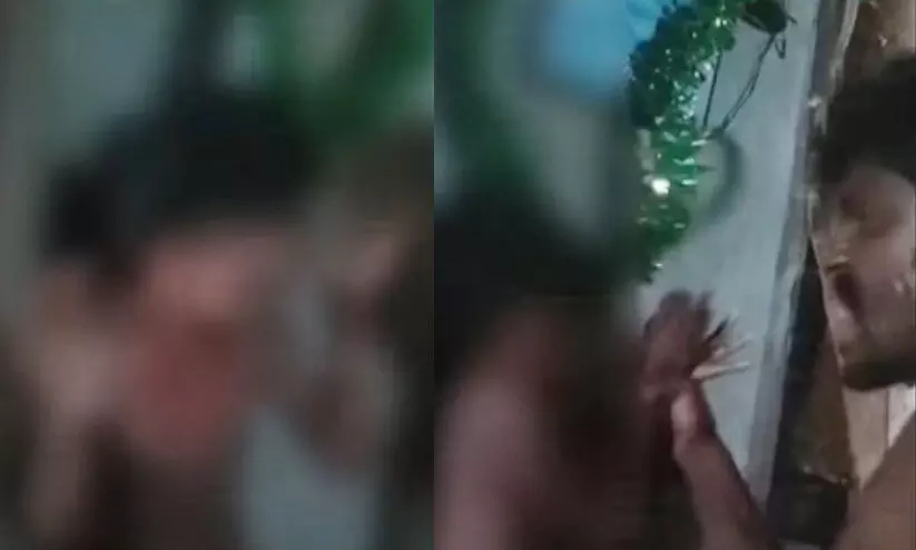 എട്ടുവയസ്സുകാരിയെ ക്രൂരമായി മർദിച്ച് പ്രാങ്ക് വീഡിയോ എന്ന് ന്യായീകരിച്ച പിതാവ് കസ്റ്റഡിയിൽ