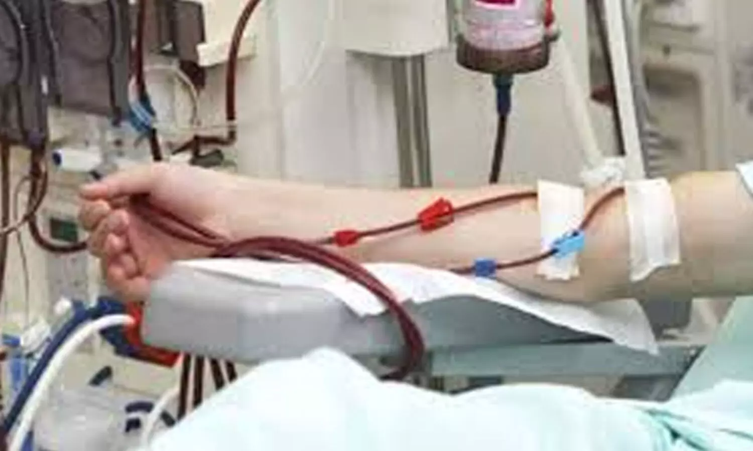 ഡയാലിസിസ് സെന്ററിൽ സൗകര്യമില്ല; രോഗികൾക്ക്​   കാത്തിരിപ്പ്