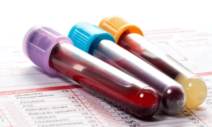 കുഞ്ഞുങ്ങളിലെ അപൂർവ ജനിതക രോഗങ്ങൾ കണ്ടെത്താൻ പുതിയ രക്ത പരിശോധന രീതി വികസിപ്പിച്ച് ഗവേഷകർ