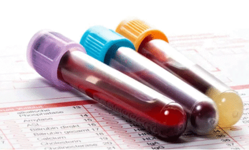 കുഞ്ഞുങ്ങളിലെ അപൂർവ ജനിതക രോഗങ്ങൾ കണ്ടെത്താൻ പുതിയ രക്ത പരിശോധന രീതി വികസിപ്പിച്ച് ഗവേഷകർ