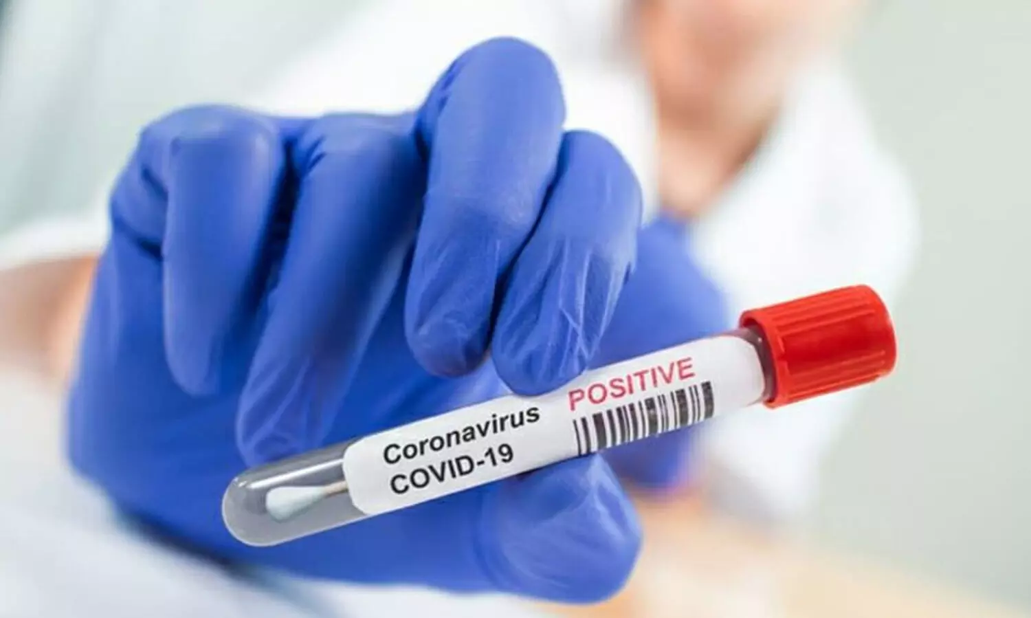 കശ്മീരിൽ കോവിഡ് ഉപ വകഭേദത്തിന്റെ ആദ്യ കേസ്; ടെസ്റ്റ് പോസിറ്റീവ് ആയത് രണ്ട് മലയാളി വിദ്യാർഥികൾക്ക്