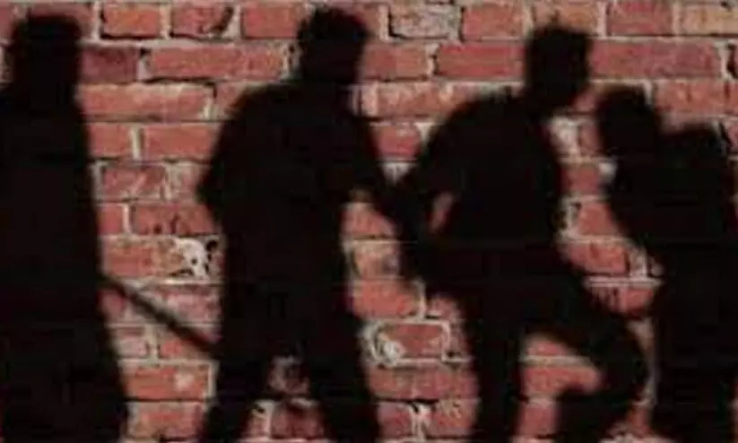 representative image representative image