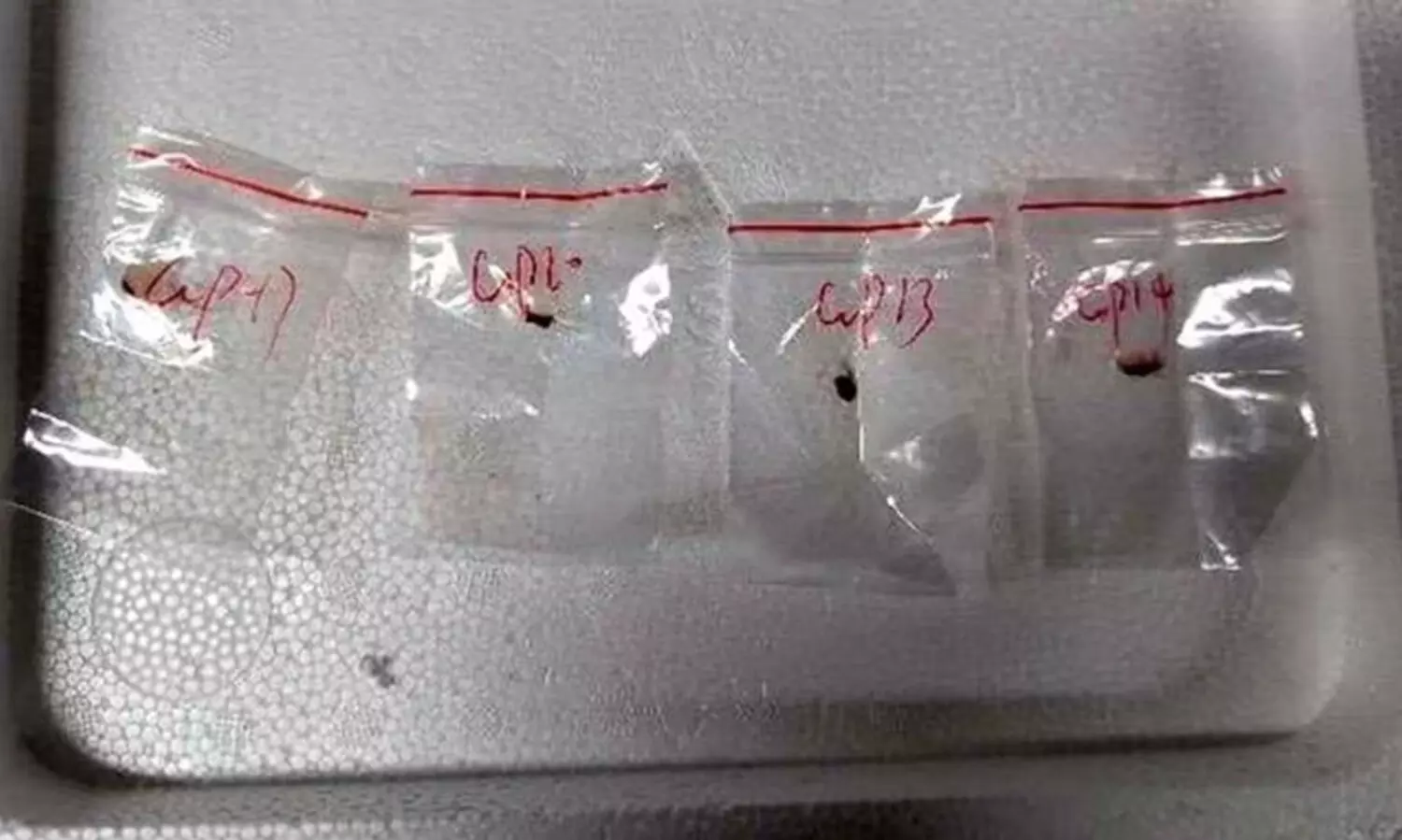 അമേരിക്കയിലേക്ക് അപകടകാരിയായ ഫംഗസുകളെ കടത്താൻ ശ്രമം; രണ്ട് ചൈനീസ് പൗരന്മാരെ അറസ്റ്റ് ചെയ്ത് എഫ്.ബി.ഐ